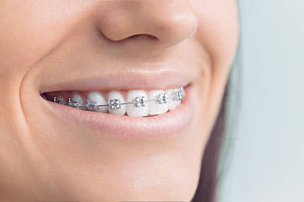 Best Dental Bonding  in Chinle, AZ